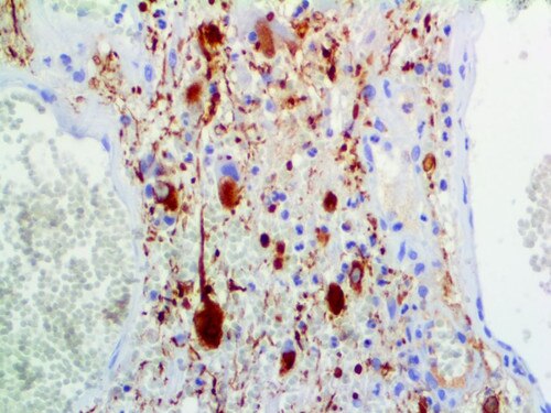 IHC of Neurofilament on an FFPE Brain Tissue